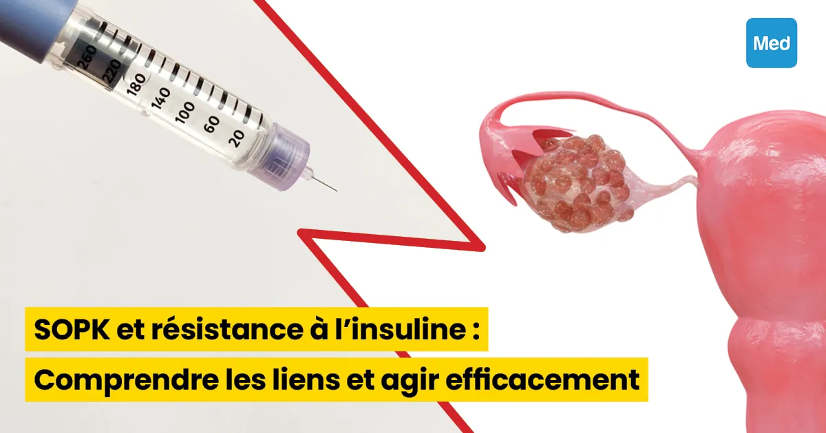 SOPK et résistance à l'insuline : Comprendre les liens et agir efficacement